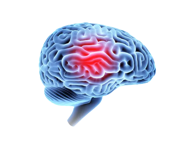 Brain Injury Lawyer